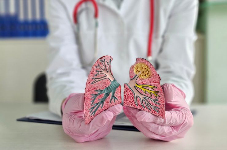 Emphysema