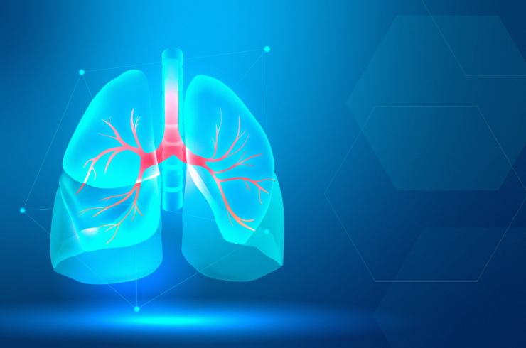 Interstitial Lung Diseases