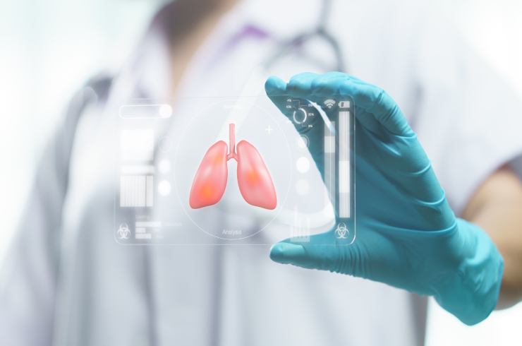 Tuberculosis